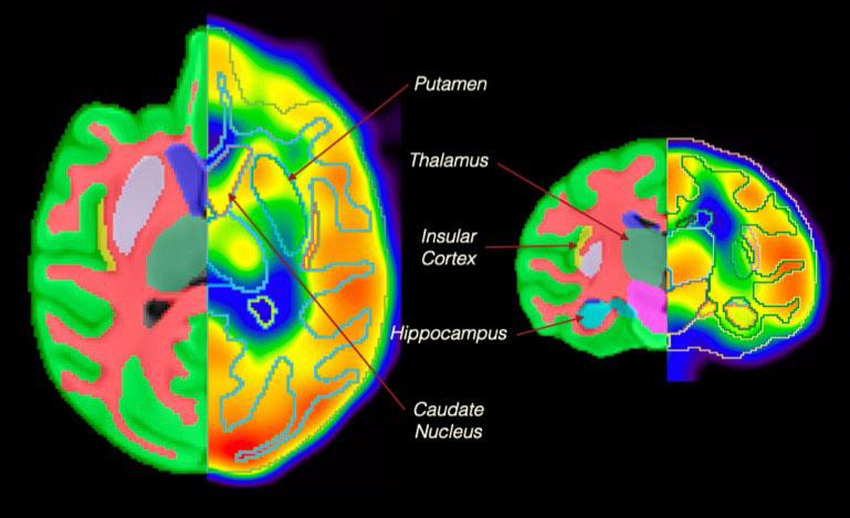 Throughput Image Howard University Molecular Imaging Lab